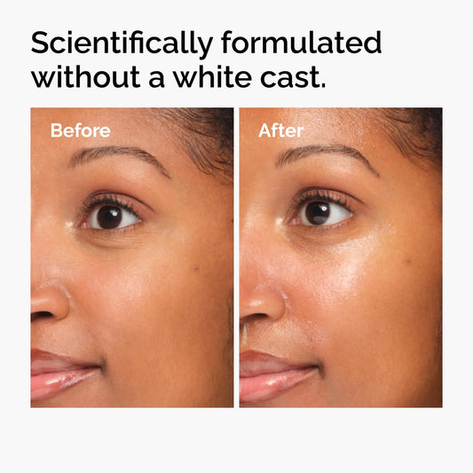 The Ordinary UV Filters SPF 45 Serum Sunscreen
