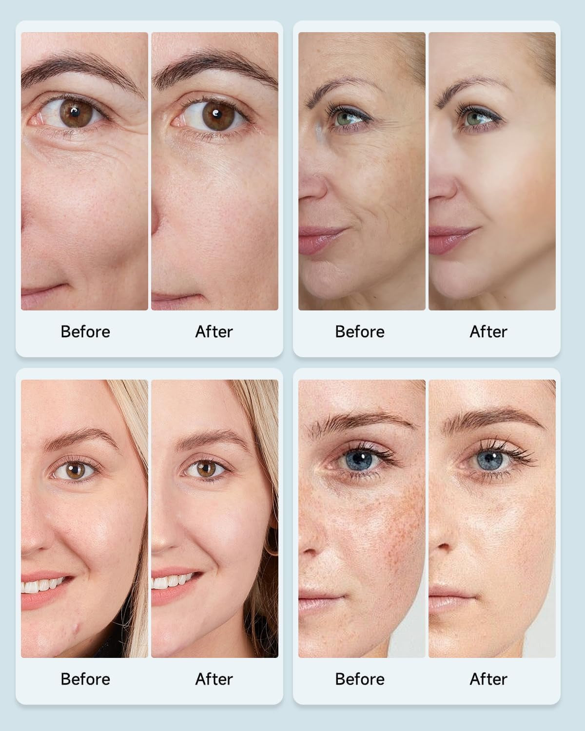 Beauty Led Mask, Red Light Therapy