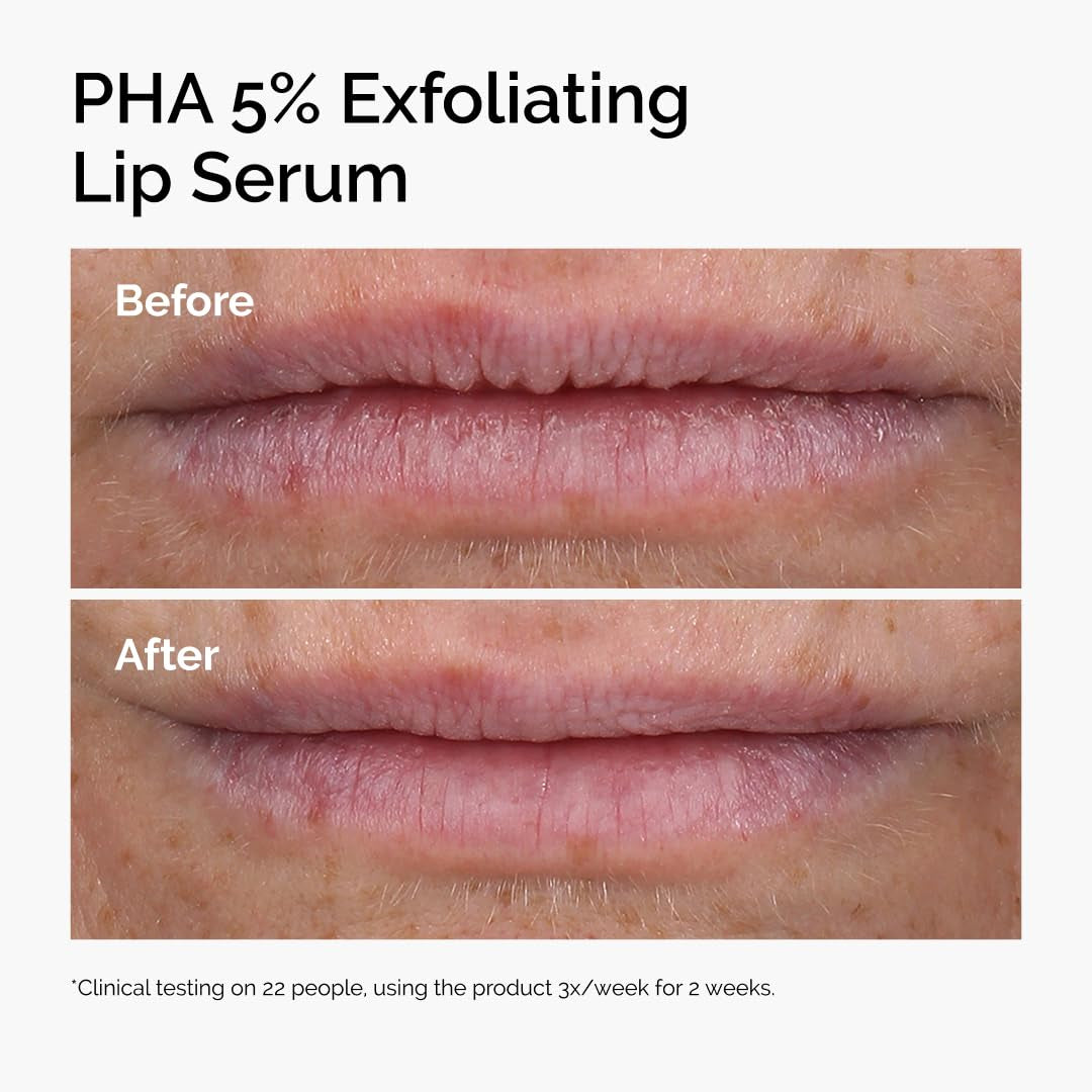 The Ordinary PHA 5% Exfoliating Lip Serum